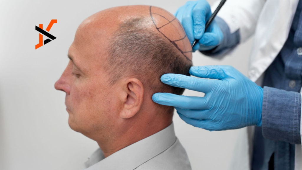 Hair loss
