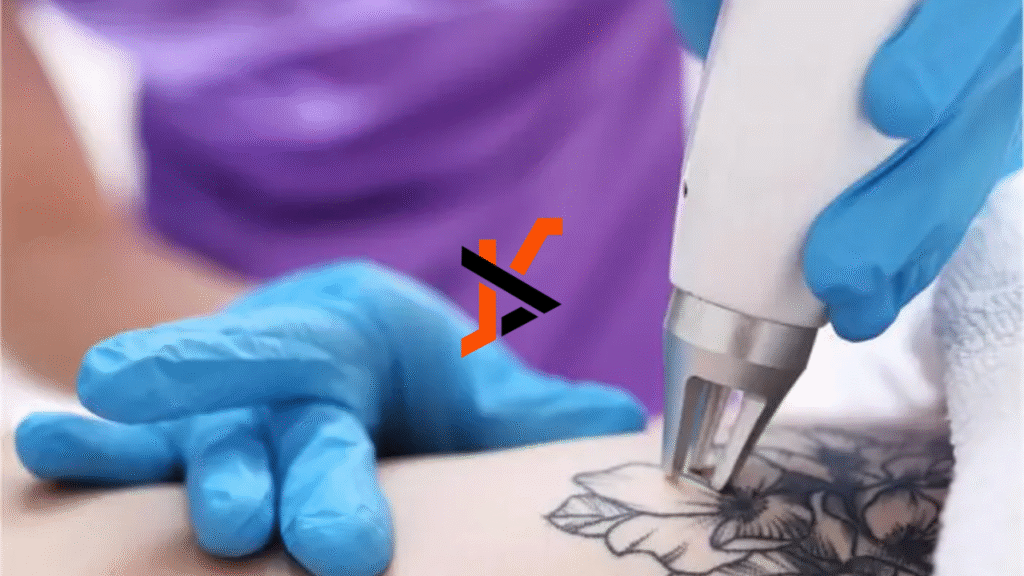 Budgeting for Laser Tattoo Removal: Breaking Down the Costs