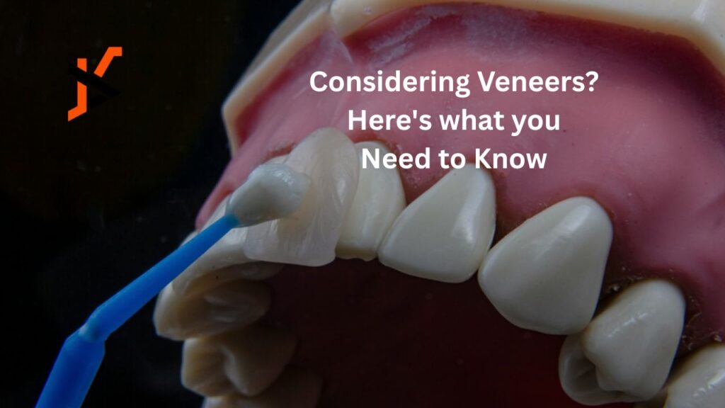 Considering Veneers? Here’s what you Need to Know Considering Veneers? Here's what you Need to Know