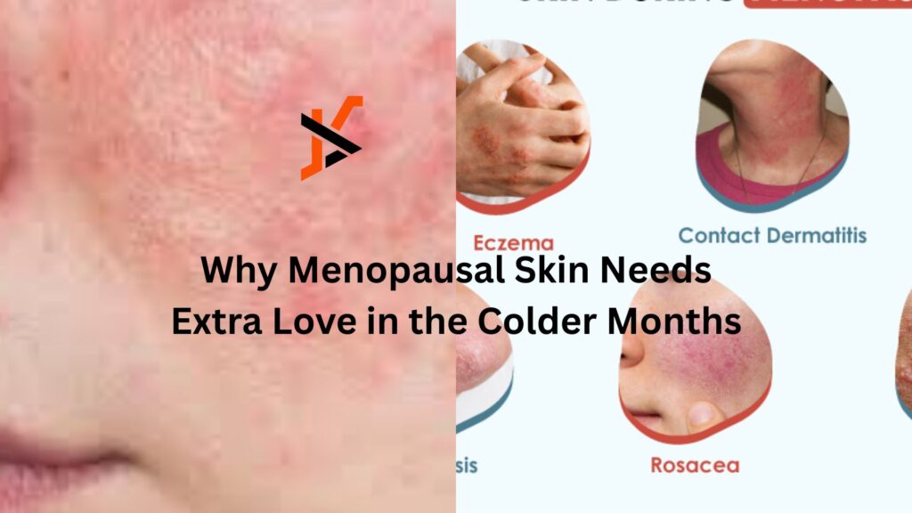 Why Menopausal Skin Needs Extra Love in the Colder Months