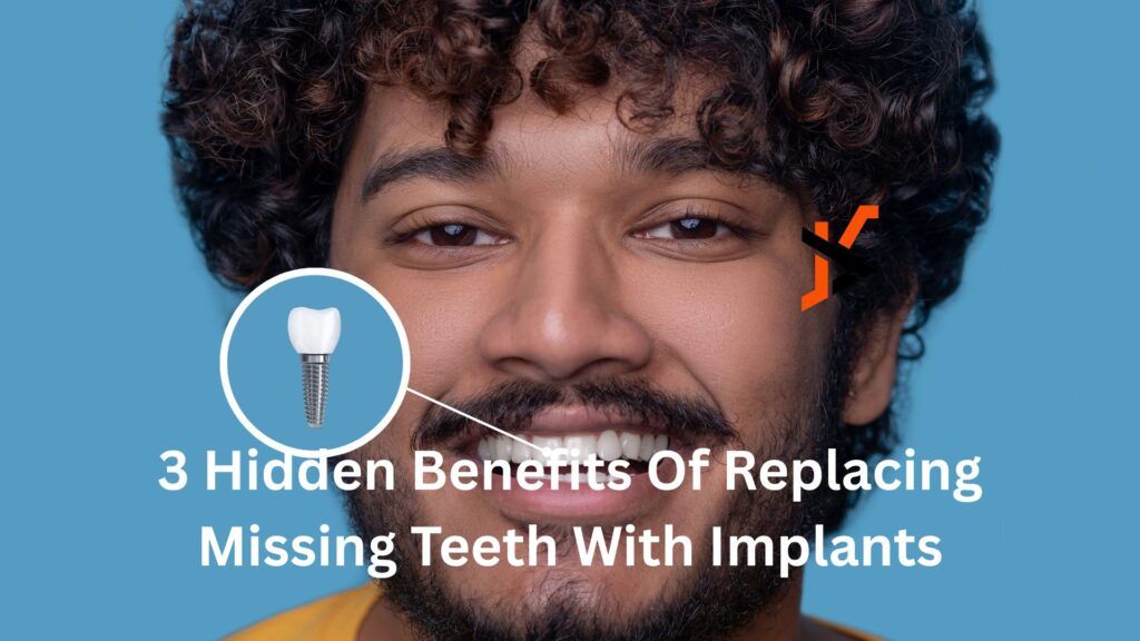 3 Hidden Benefits Of Replacing Missing Teeth With Implants