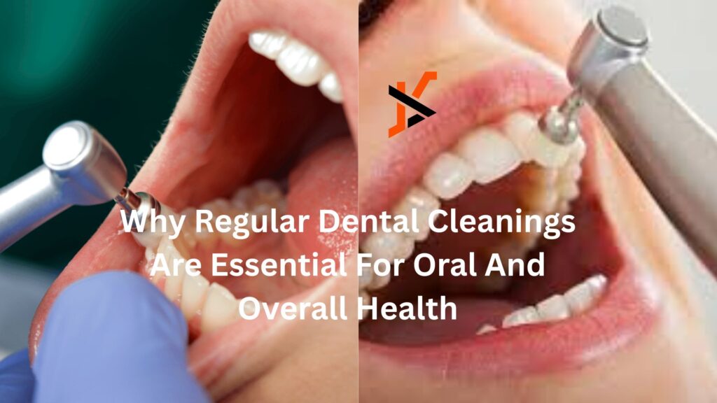 Why Regular Dental Cleanings Are Essential For Oral And Overall Health